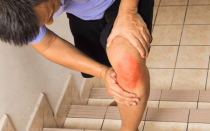 Ревматизм ног признаки и лечение